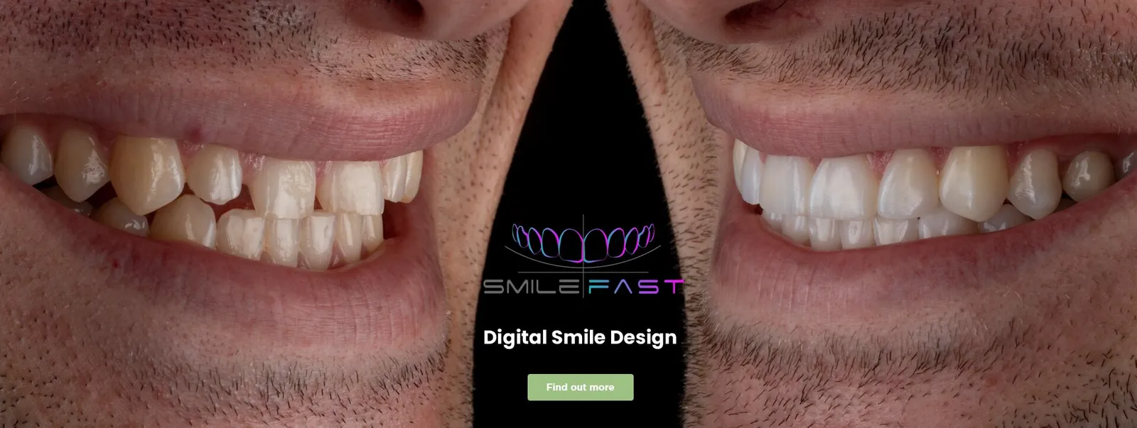 digital smile design digital smile design